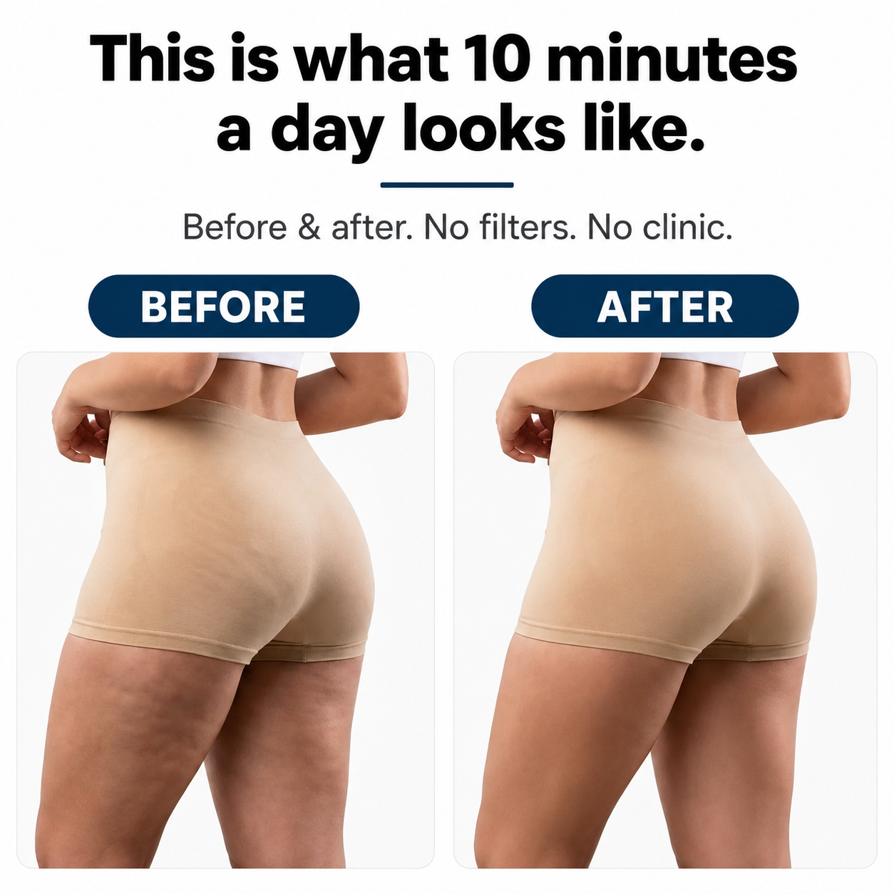 Velliti™ Sculpt Roller